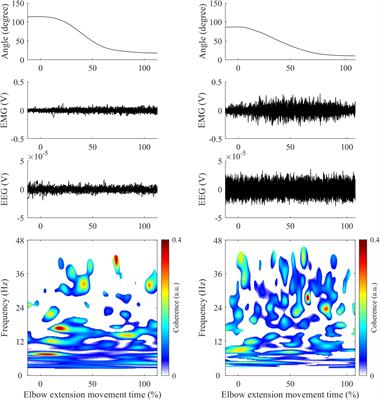 Temporal Dynamics of Corticomuscular Coherence Reflects Alteration of the Central Mechanisms of Neural Motor Control in Post-Stroke Patients